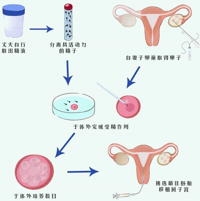 高龄女性二胎可以试管代怀上户口吗？