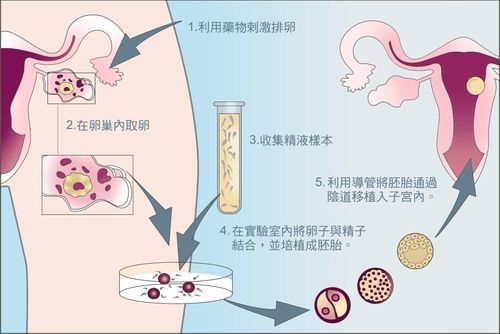 北京省妇幼保健院做单周期供精人授的费用大概是多少？