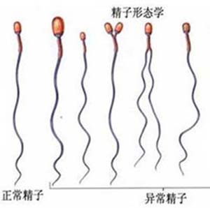 优生优育不了解怎么取环的姐妹看过来+看完全过程你就知道了